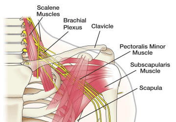 Lesione del plesso brachiale
